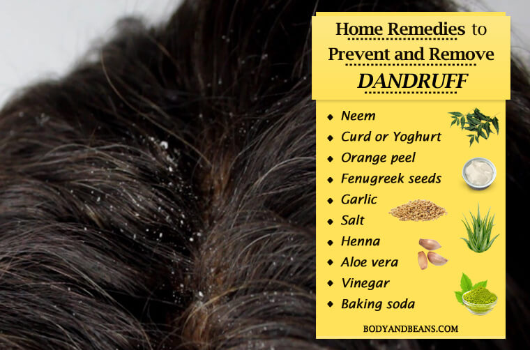 Home Remedies to Prevent and Remove Dandruff Easily at Home