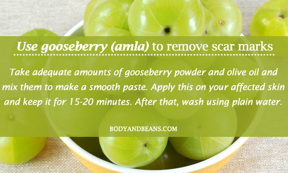 Use gooseberry (amla) to remove scar marks