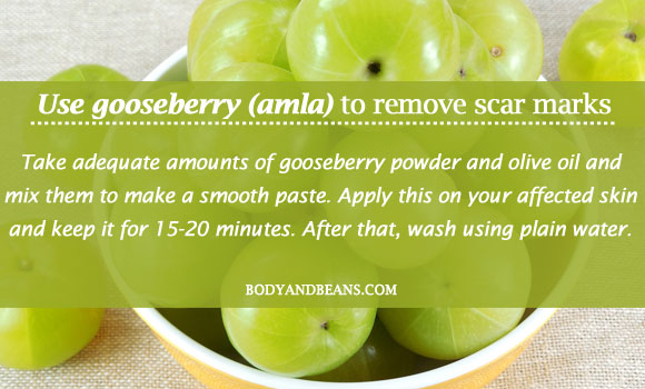 Use gooseberry (amla) to remove scar marks