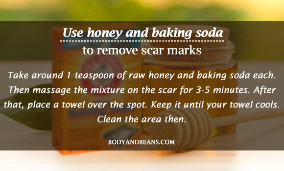 Use honey and baking soda to remove scar marks