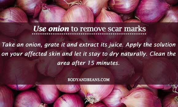 Use onion to remove scar marks