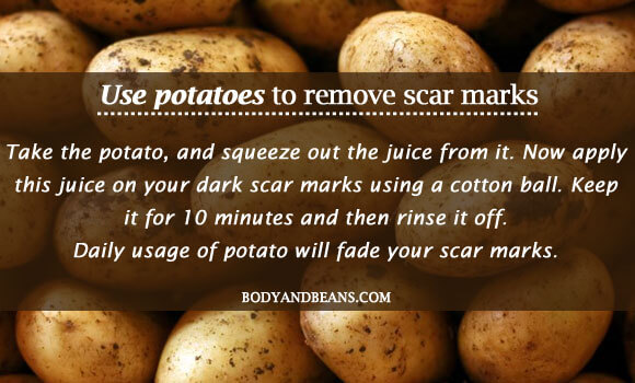 Use potatoes to remove scar marks