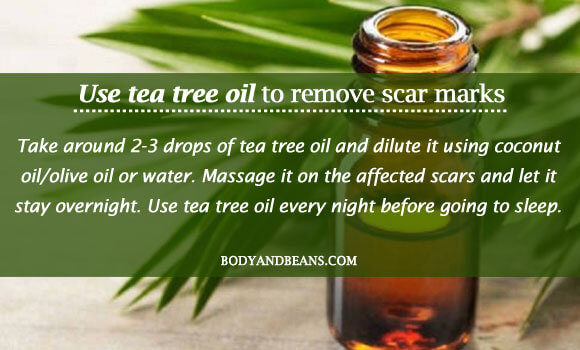 Use tea tree oil to remove scar marks