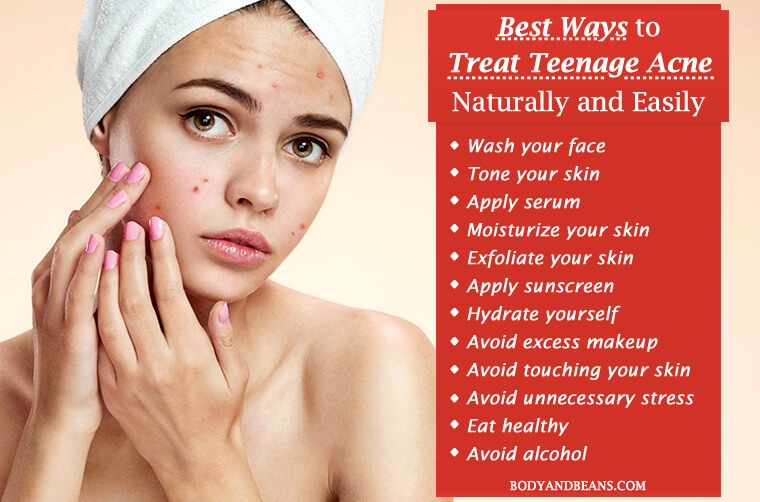 14 Best Ways to Treat Teenage Acne Naturally and Easily 14 Best Ways to Treat Teenage Acne Naturally and Easily