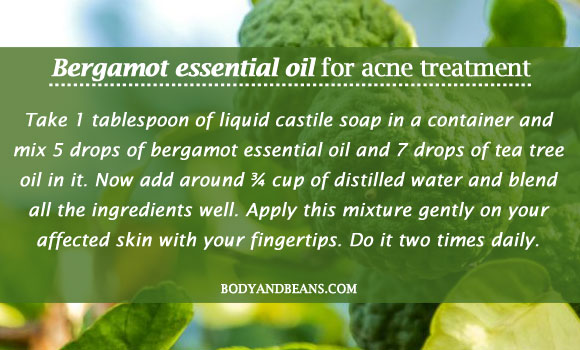 Bergamot essential oil for acne