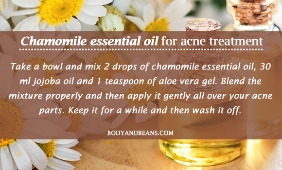 Chamomile essential oil for acne