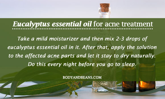 Eucalyptus essential oil for acne treatment