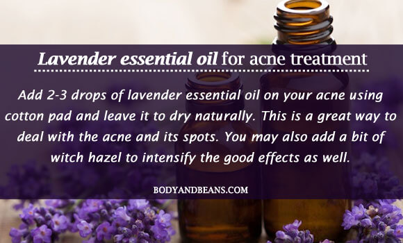 Lavender essential oil for acne treatment