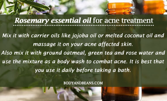 Rosemary essential oil for acne treatment