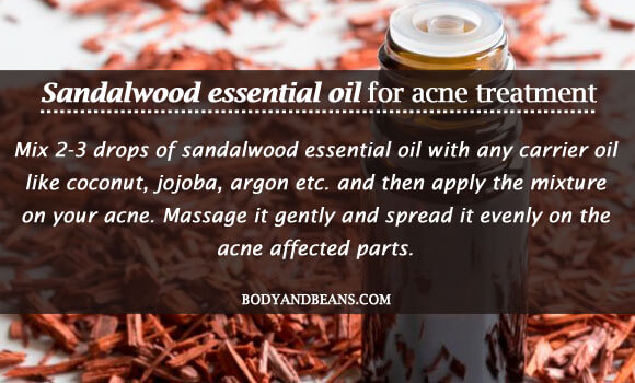 Sandalwood essential oil for acne