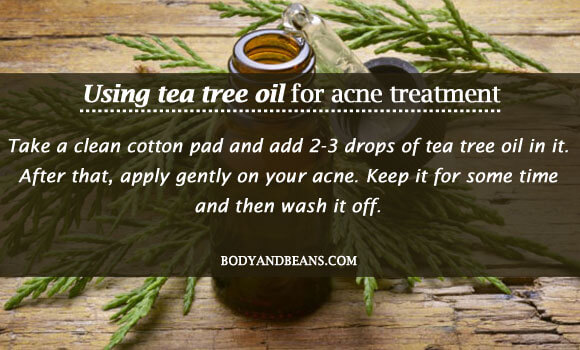 Using tea tree oil for acne treatment