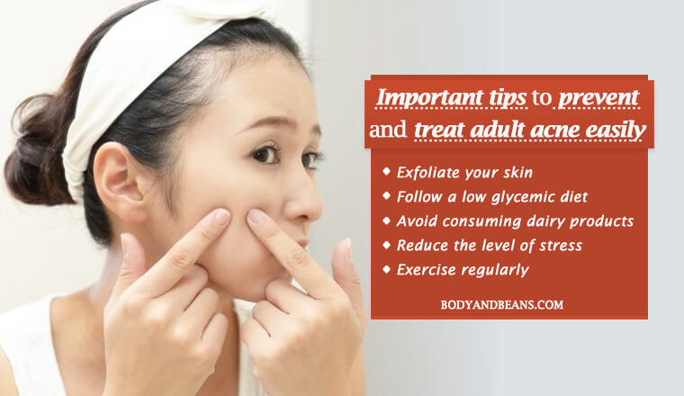 Important tips to prevent and treat adult acne easily