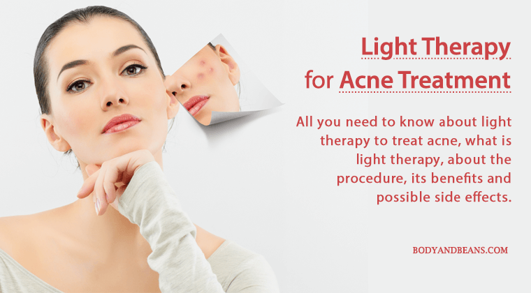 All about light therapy for Acne treatment: the benefits and possible side effects